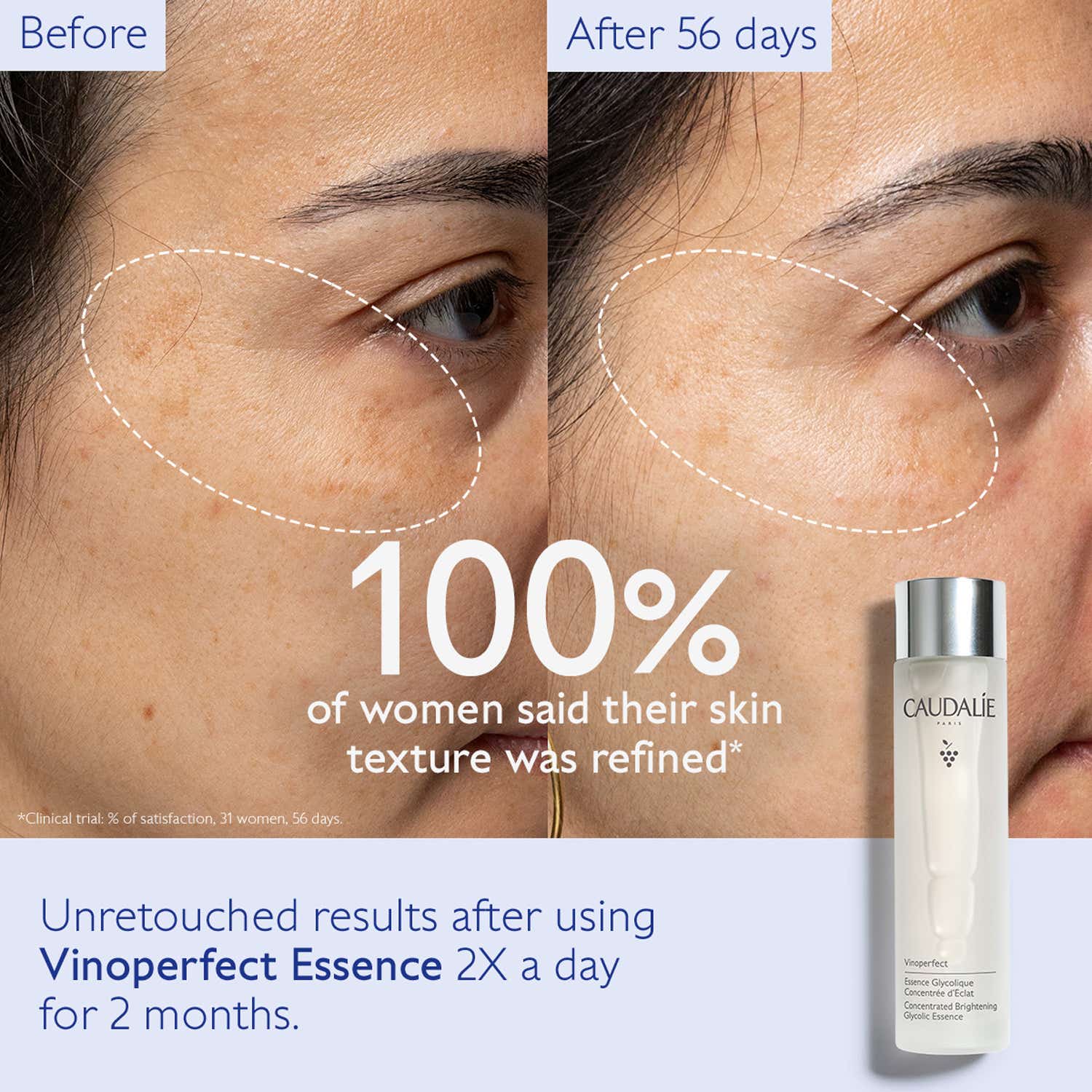 Caudalie Vinoperfect Concentrated Brightening Glycolic Essence (150ml) - Caudalie