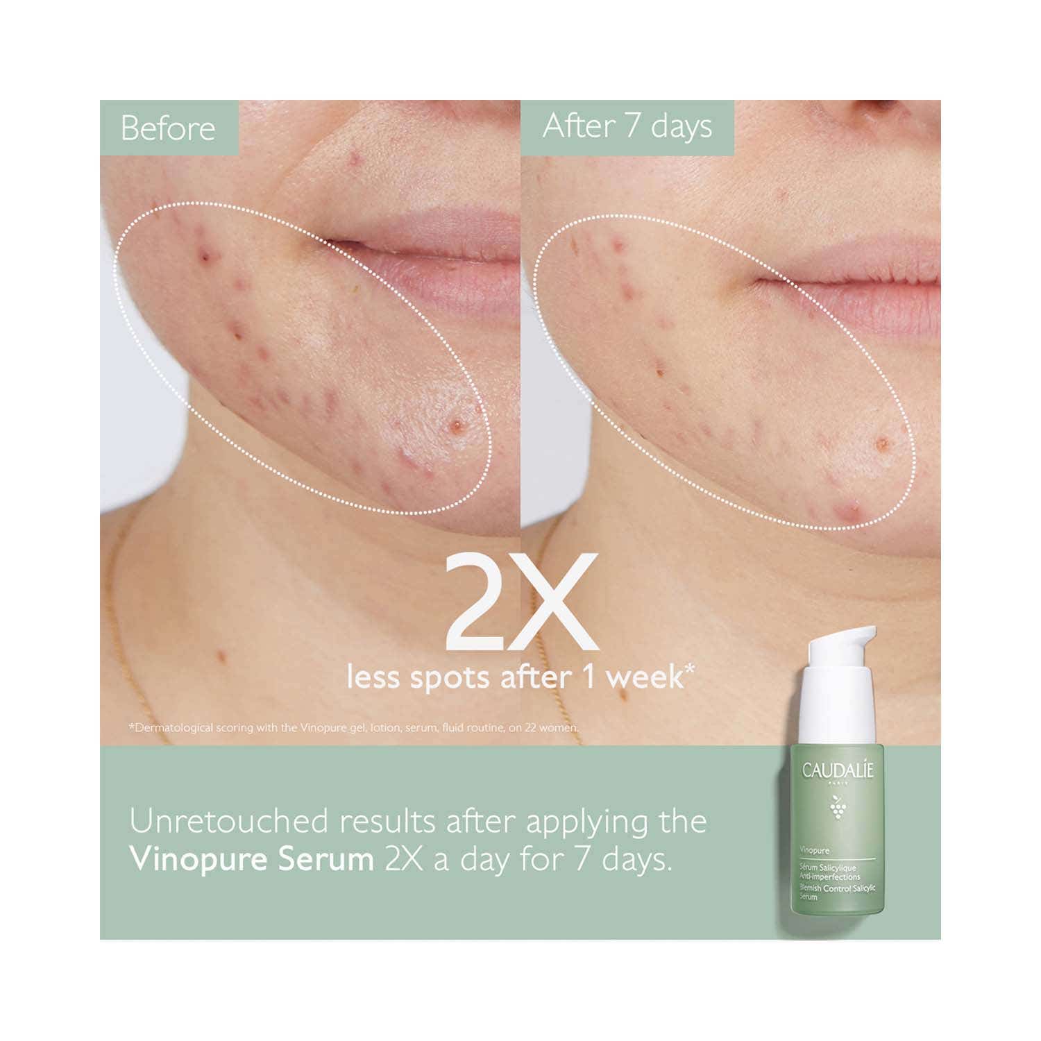 Caudalie Vinopure Anti-Blemish Duo Set (2 pcs) - Caudalie