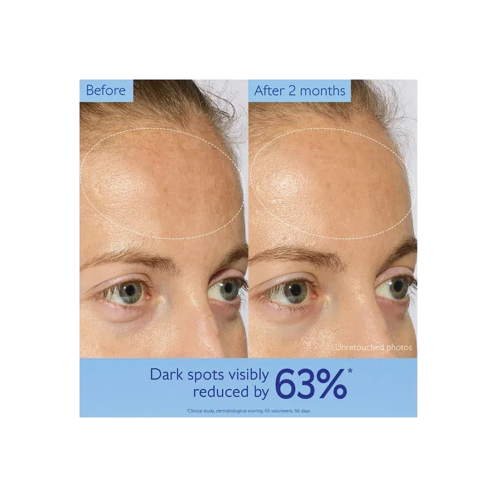 Caudalie Vinoperfect Brightening Dark Spot Serum Vitamin C Alternative