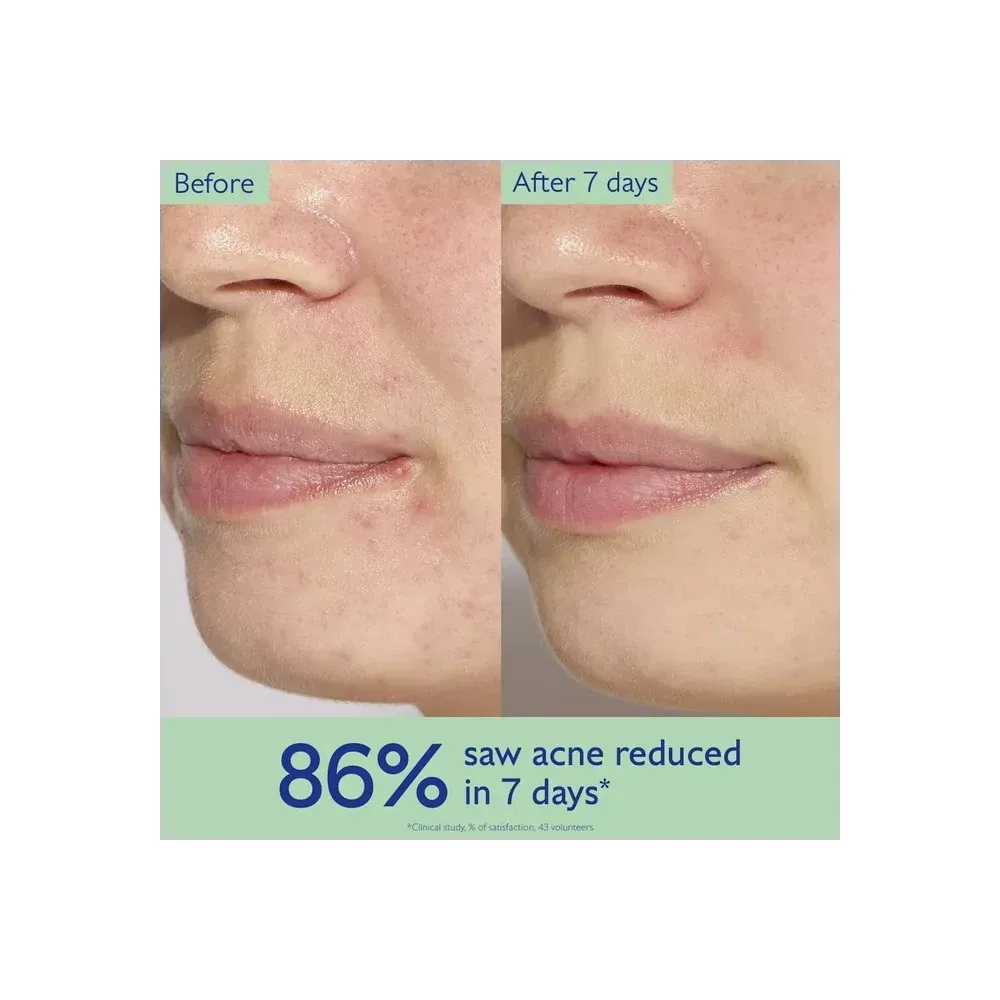 Caudalie Vinopure Acne Serum To Treat And Prevent Blemishes
