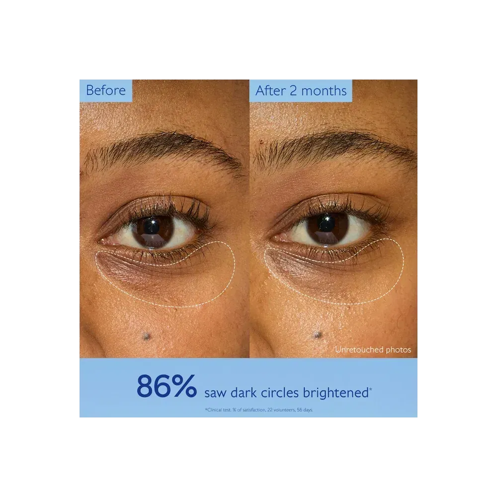 Caudalie Vinoperfect Dark Circle Brightening Eye Cream With Niacinamide