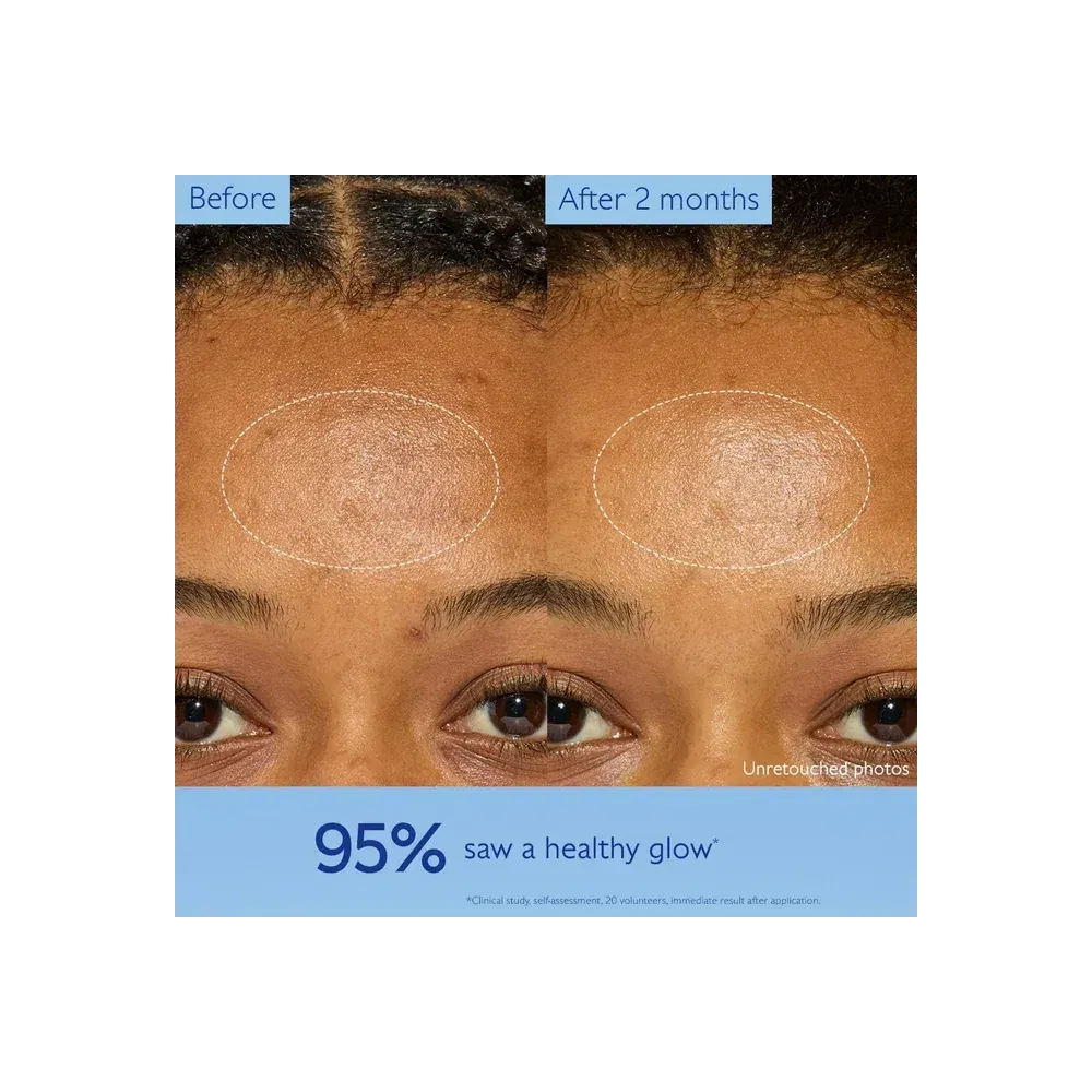 Caudalie Vinoperfect Dark Spot Brightening Moisturizer With Niacinamide
