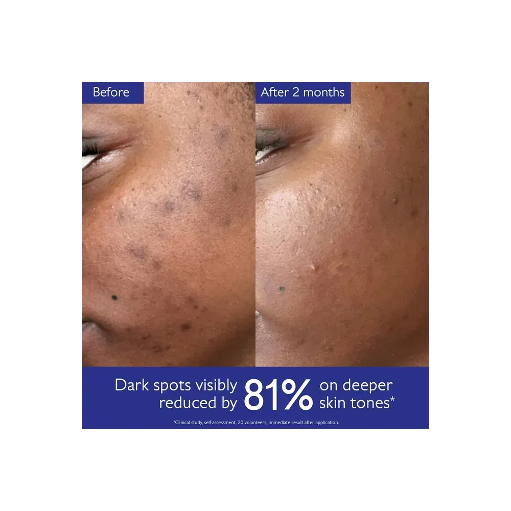 Caudalie Vinoperfect Brightening Routine For Dark Spots