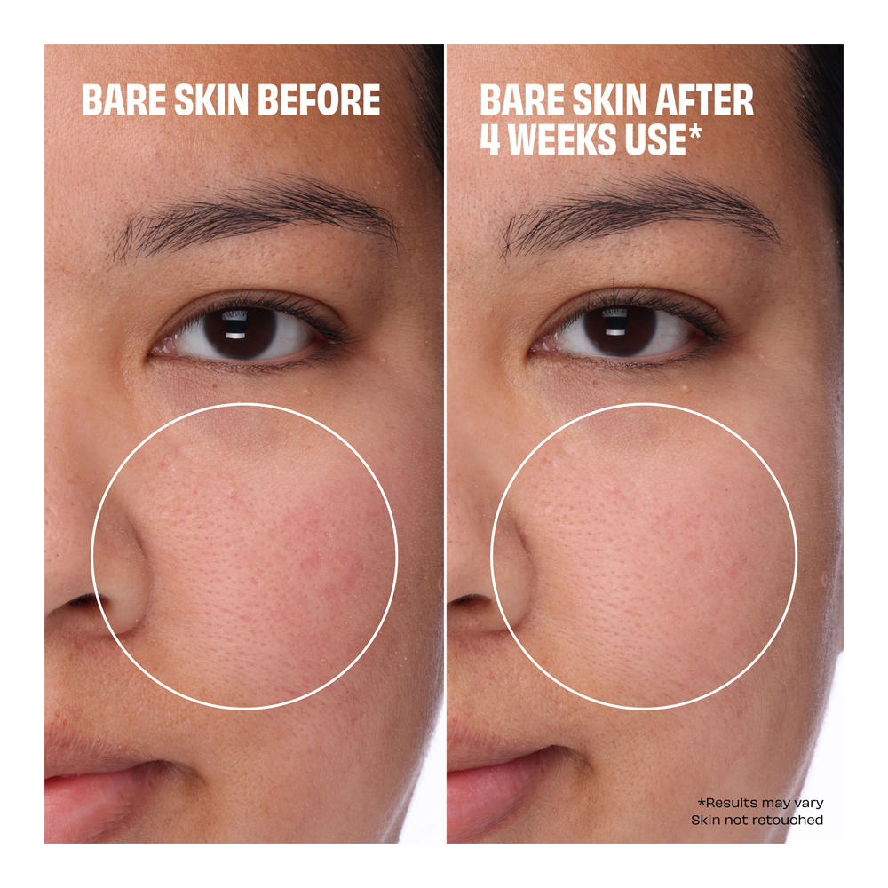 The Porefessional Foundation