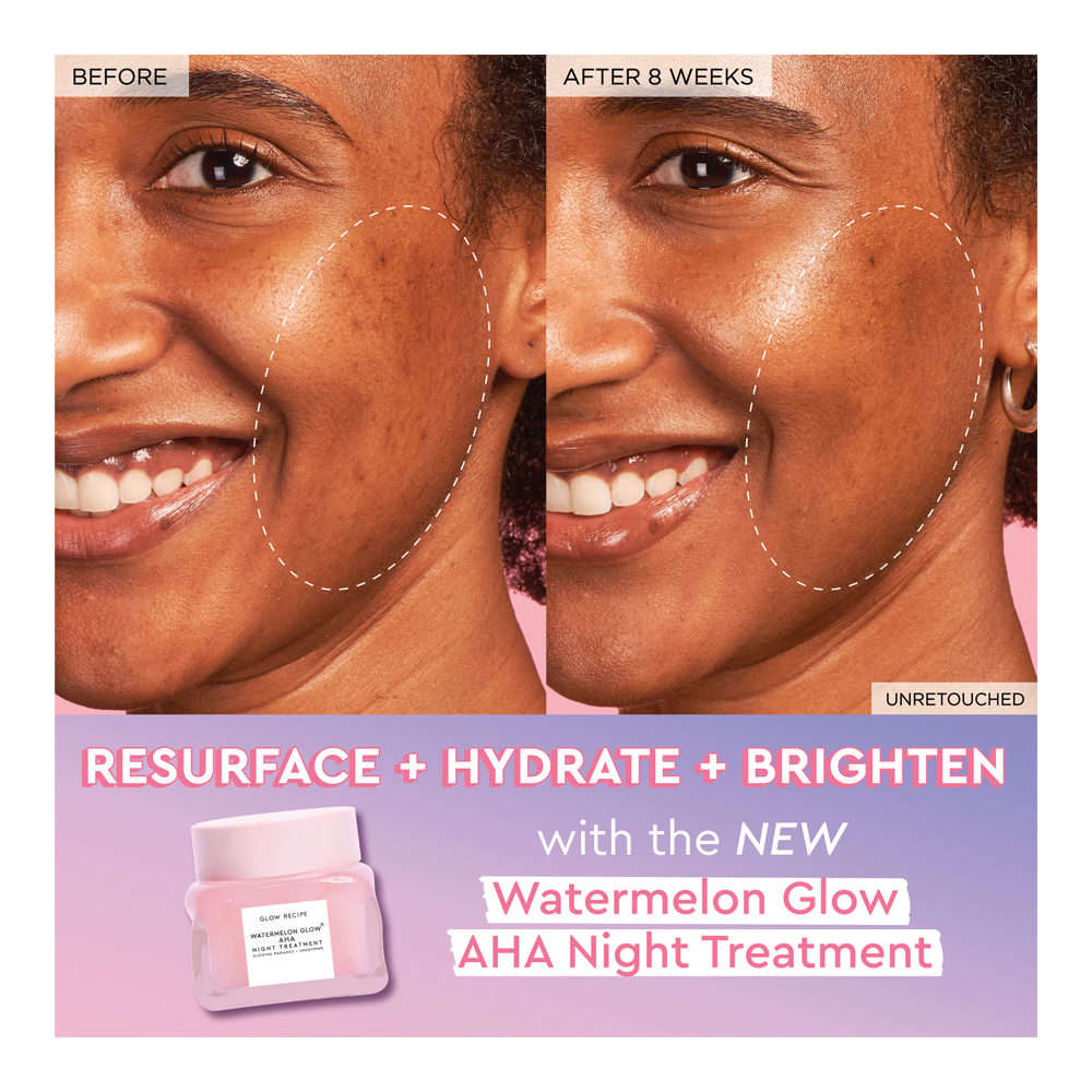 Watermelon Glow AHA Night Treatment