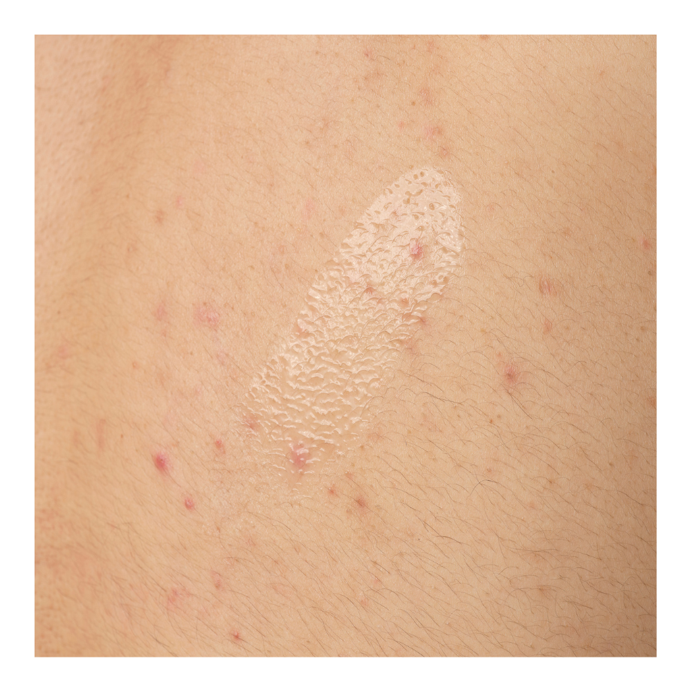 Salicylic Acid 0.5% Body Serum